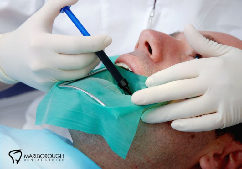 The Evolution of Root Canal Technology: Safer, Faster, and More Efficient